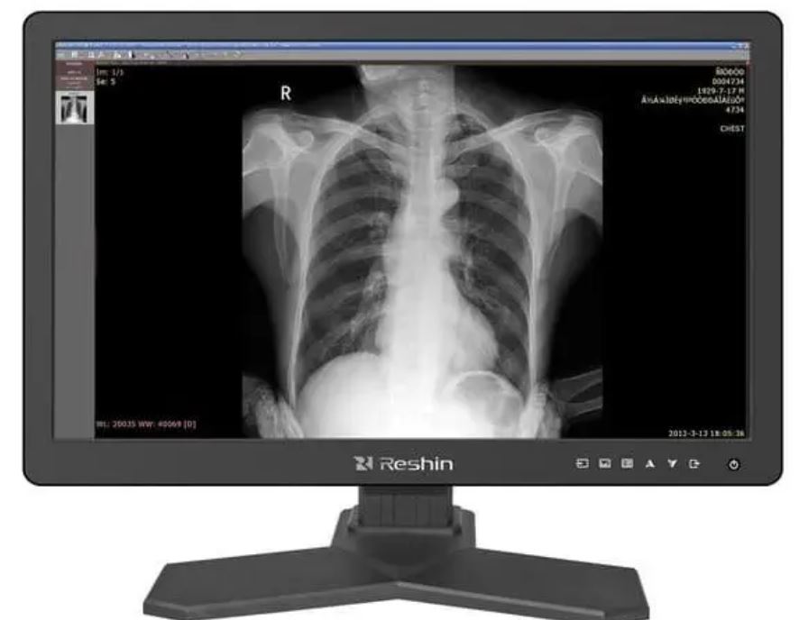 Обзор RESHIN MD26GA: медицинский диагностический монитор 21,3" 2MP для рентгенологии, КТ, МРТ и PACS — экспертное тестирование